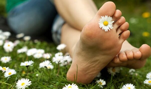 Legs without varicose veins after prevention with home remedies.